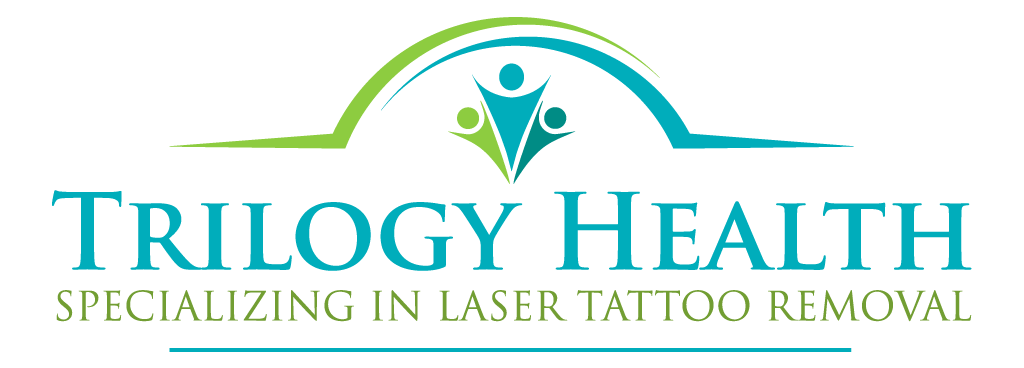 San Diego Tattoo Removal